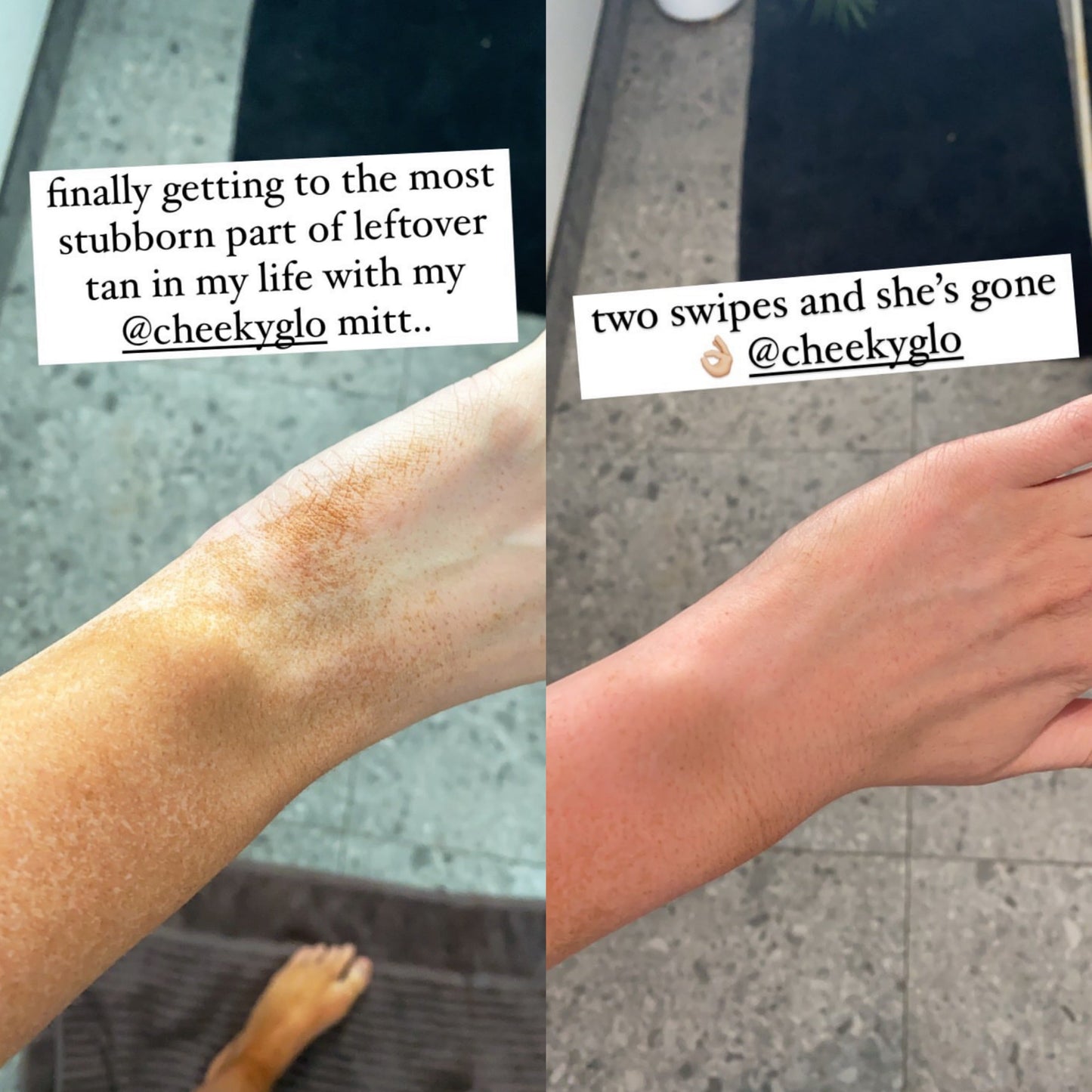 ScrubBae™ - Exfoliating Glove